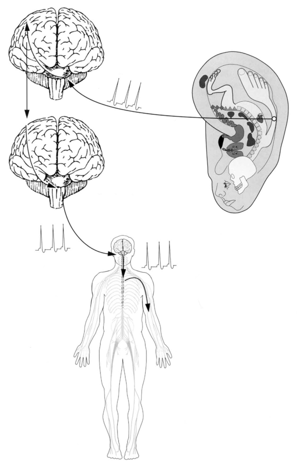 auricoloterapia cervello