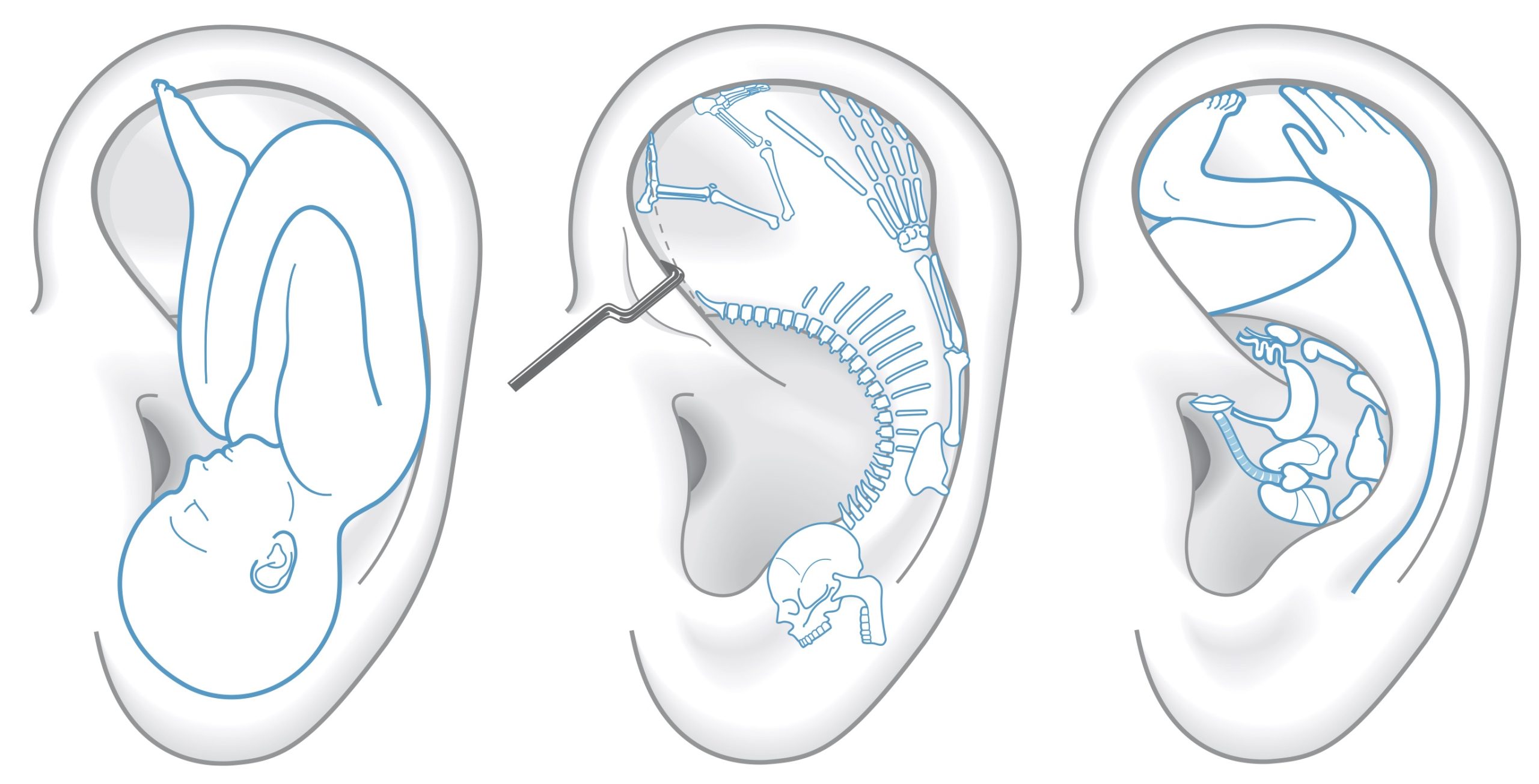 auricoloterapia mappa